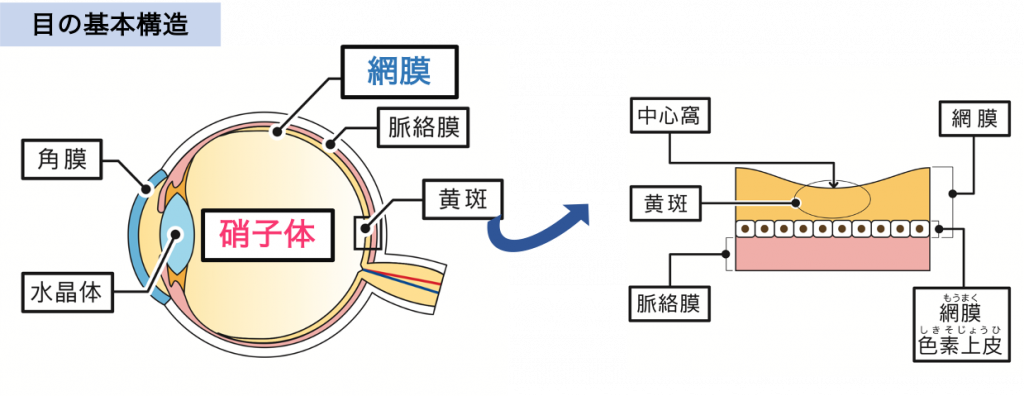 網膜硝子体手術（硝子体手術） | 新小岩眼科