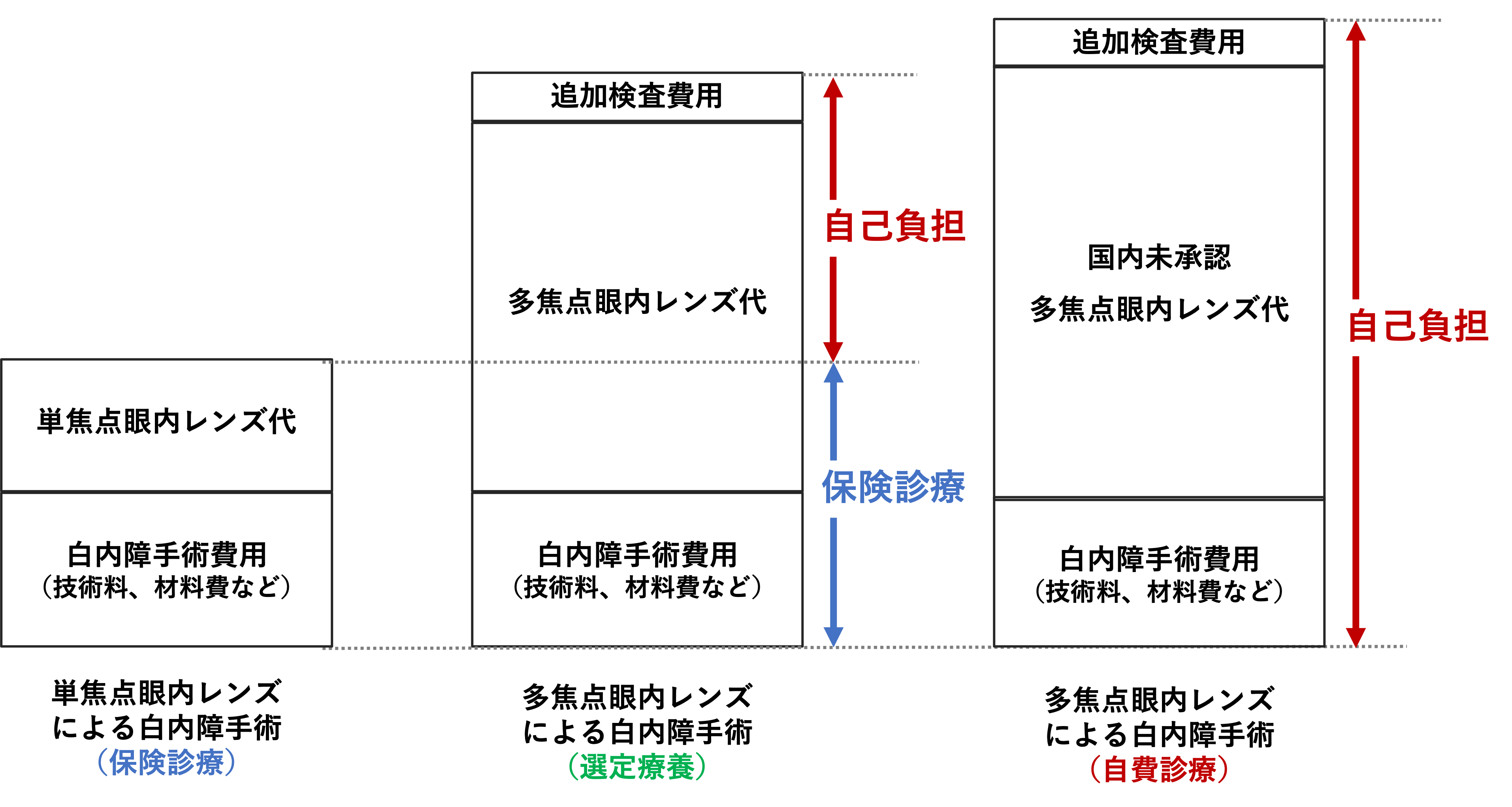 白内障手術費用