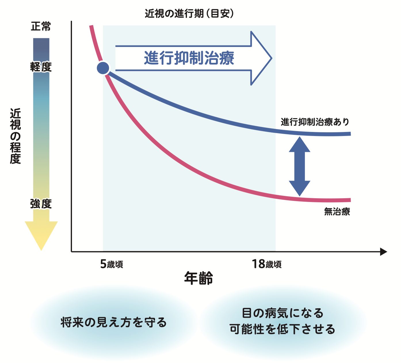 近視進行抑制のイメージ